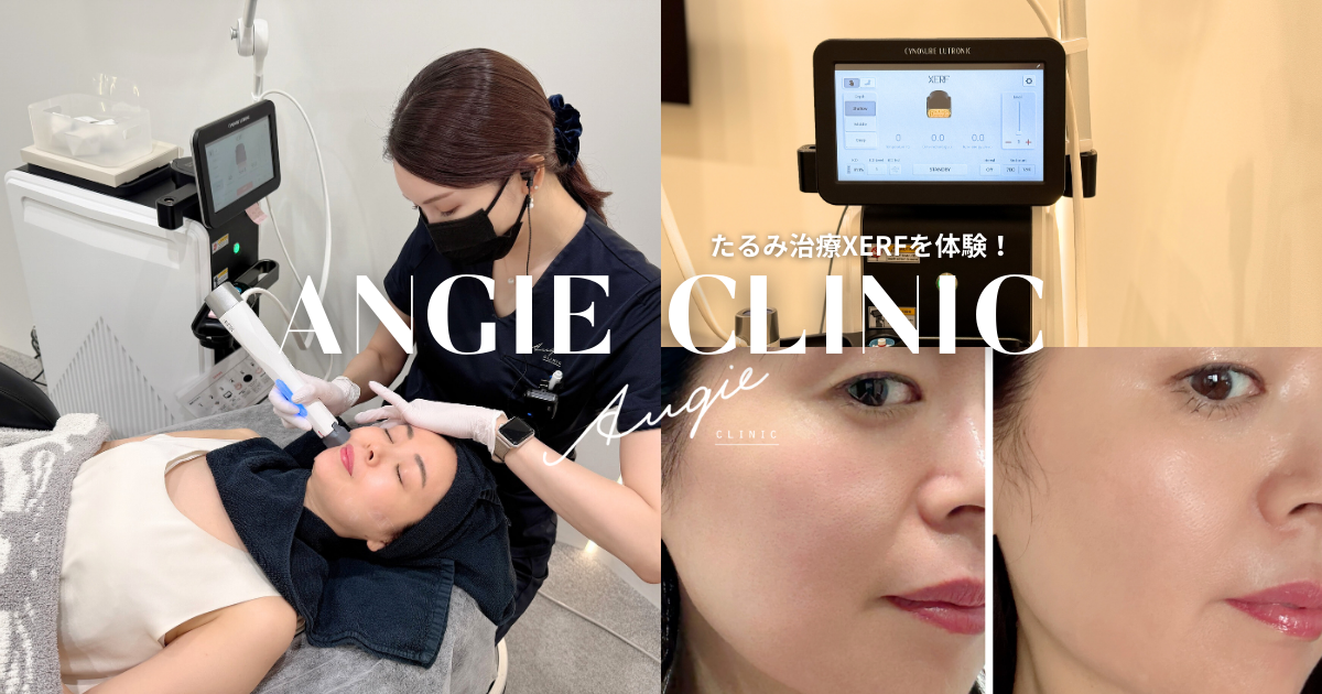 ANGIE CLINIC