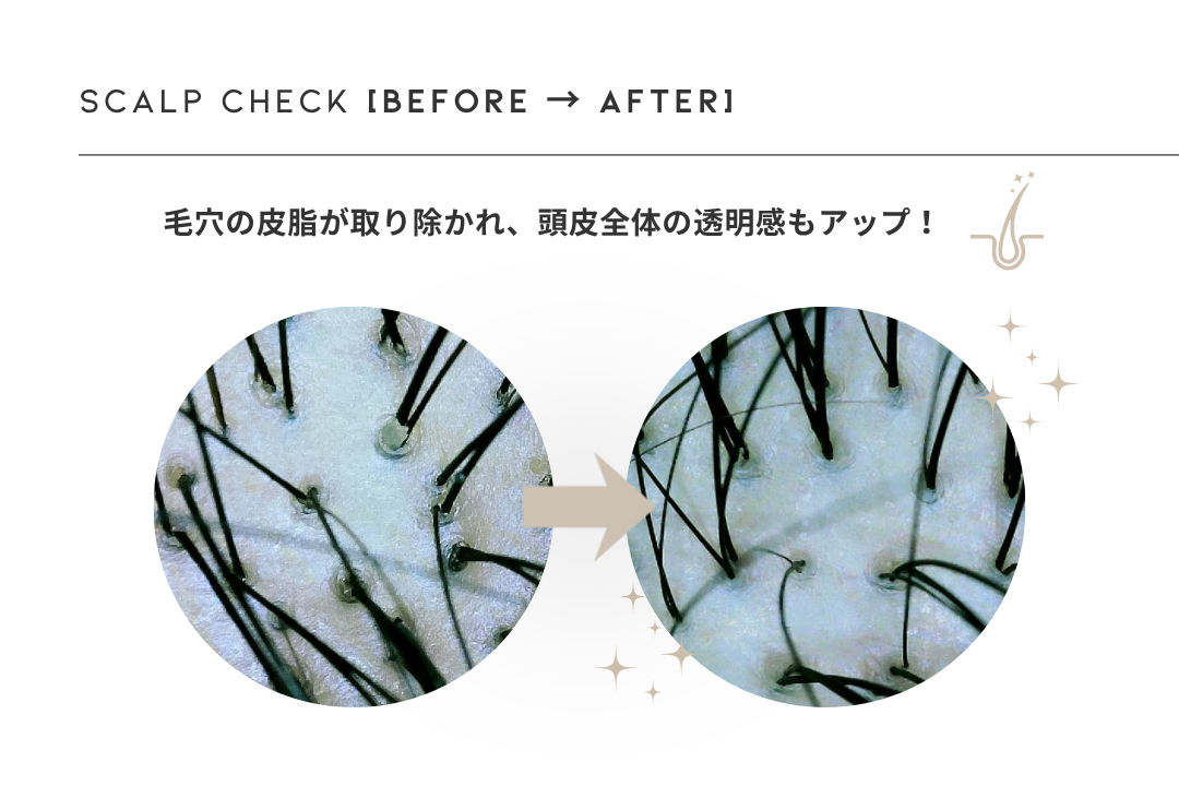 頭皮チェック BEFORE AFTER